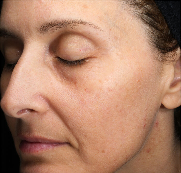 Eye and Lip Contour Regenerating Cream,