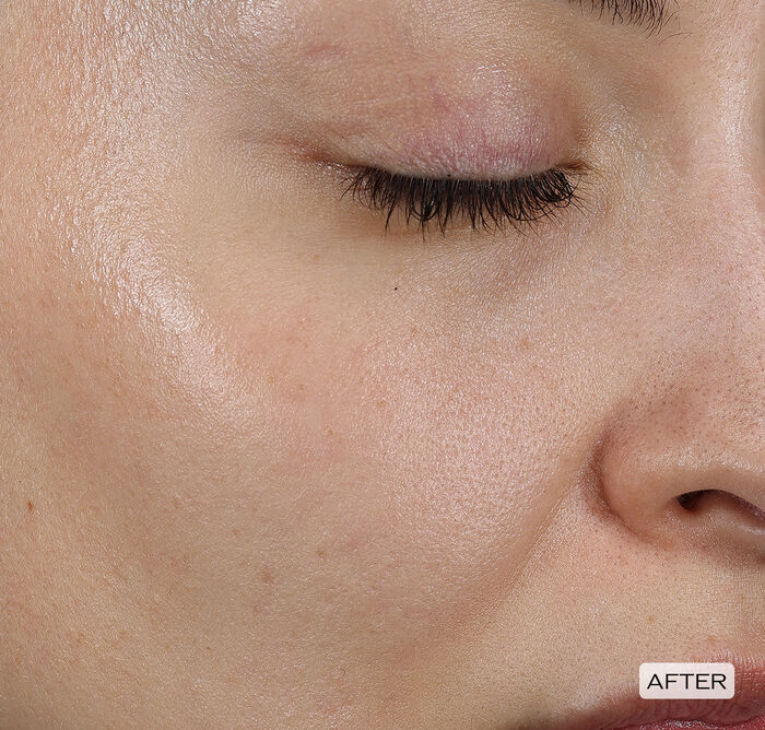 Dark Spot and Wrinkle Smoothing Serum,