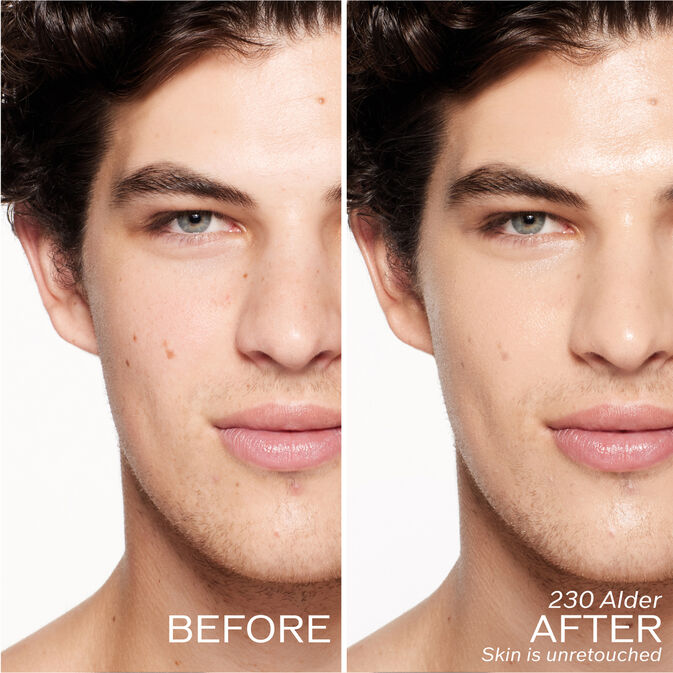 Two photos of a model. The first is a before shot, and the second is after using 230 Alder. Skin is unretouched.