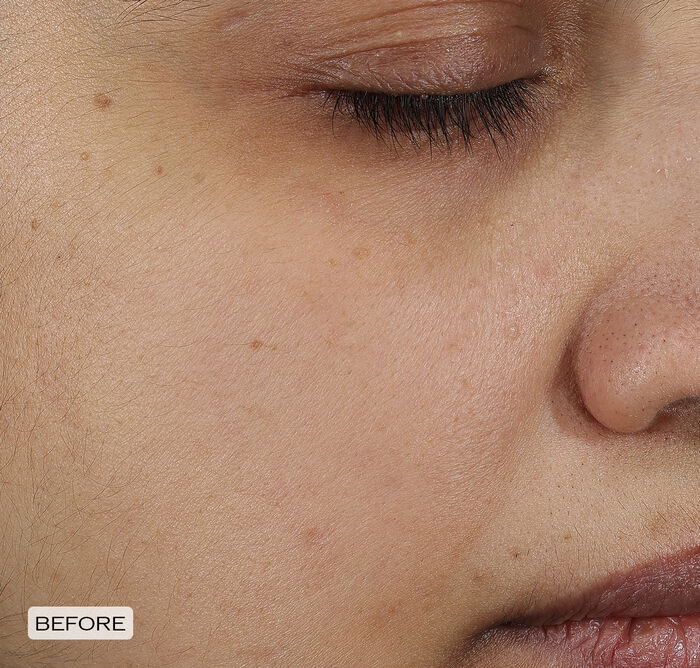 Brightening and Wrinkle Smoothing Cream,