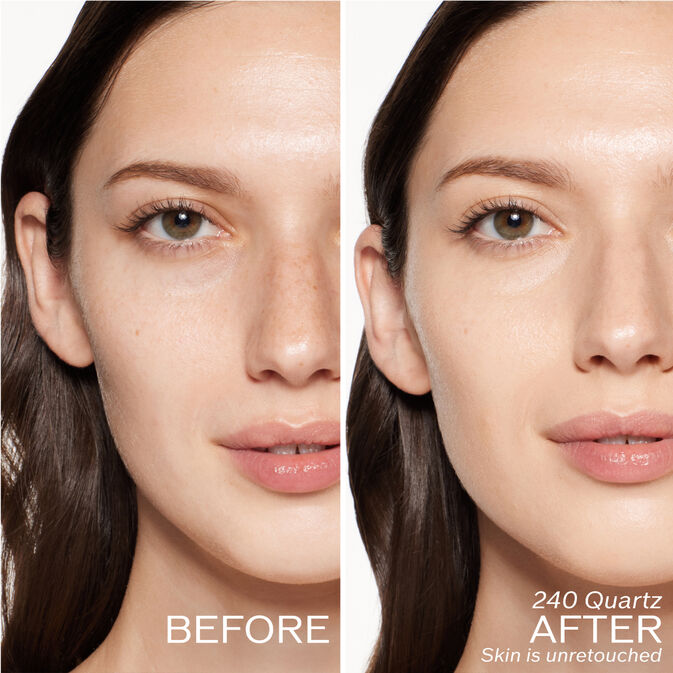 Two photos of a model. The first is a before shot, and the second is after using 240 Quartz. Skin is unretouched.