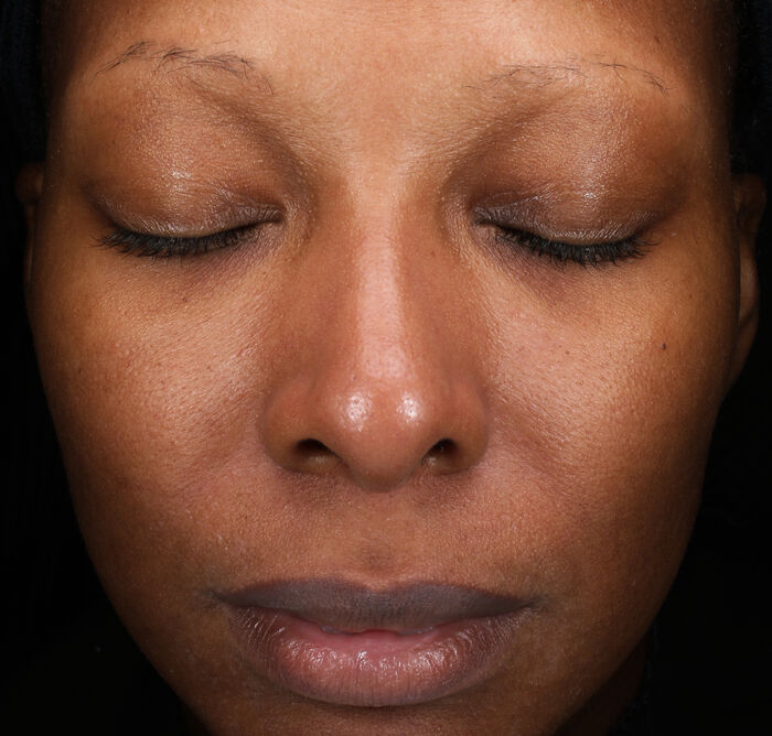 Total Regenerating Cream,