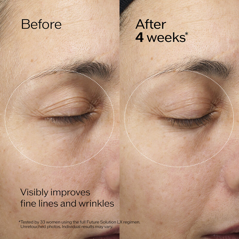 Regenerating Ritual Set (valor de -$282,