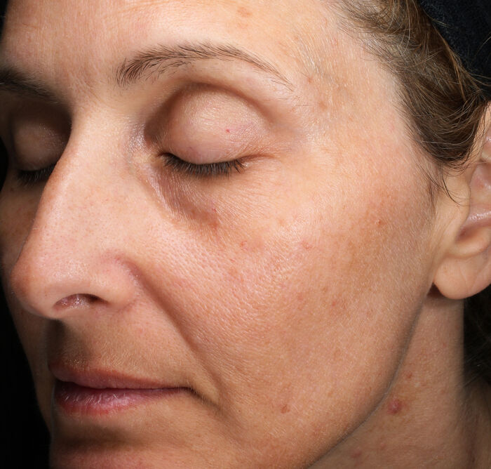 Eye and Lip Contour Regenerating Cream,