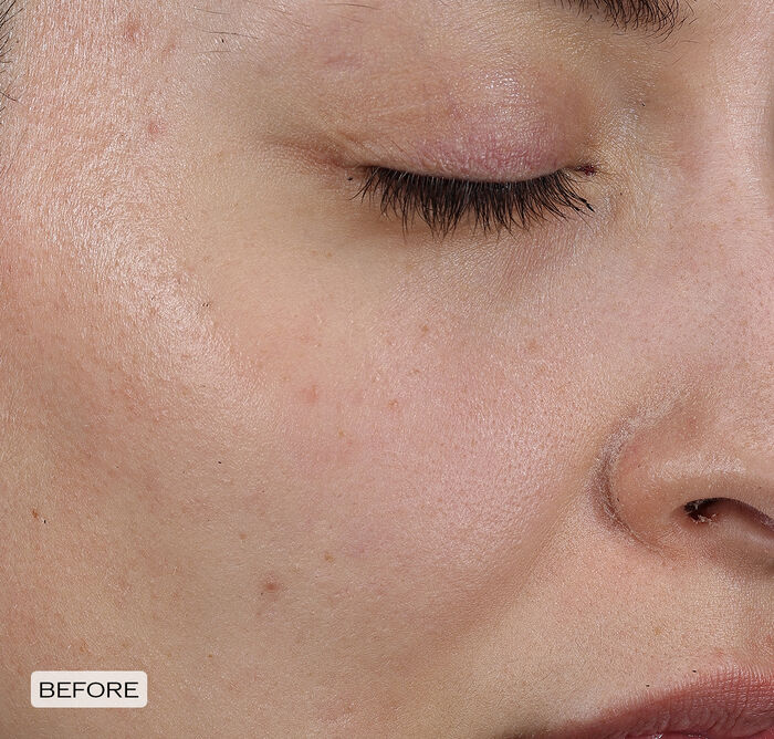 Dark Spot and Wrinkle Smoothing Serum,