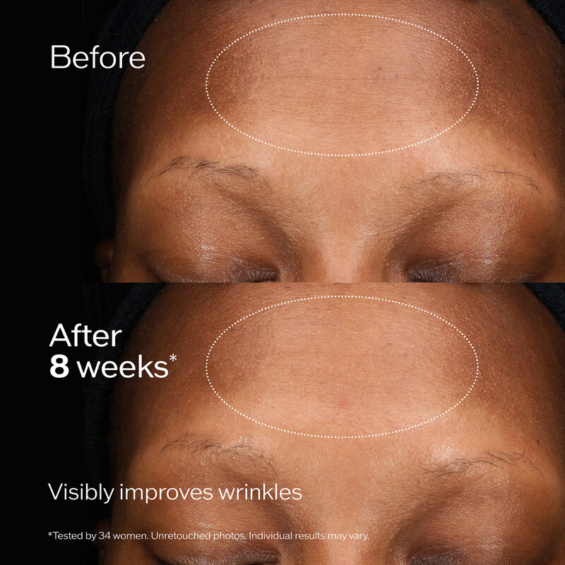 Total Regenerating Cream,