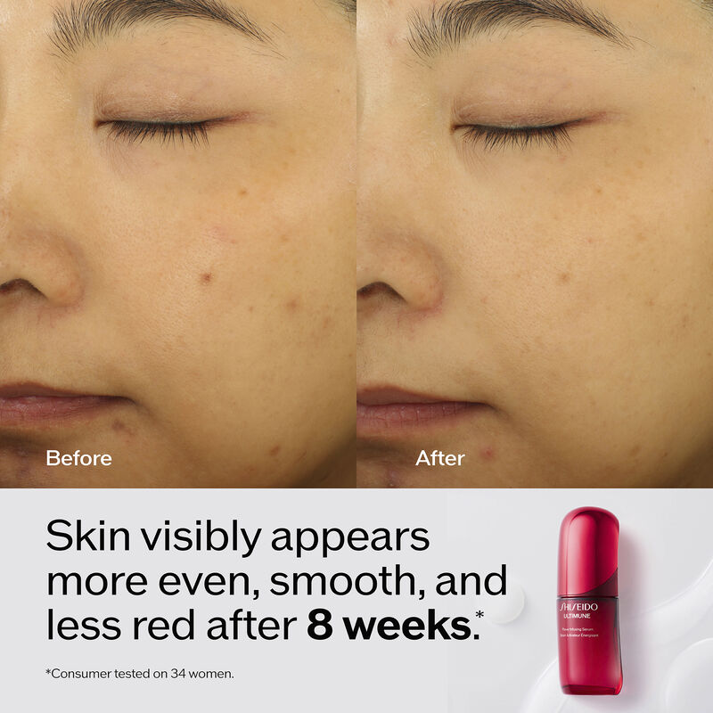 Imágenes del antes y el después del rostro de una persona, en las que se aprecia una piel visiblemente más uniforme, suave y con menos rojeces tras 8 semanas. También se muestra un envase rojo de Shiseido UltiMune Serum.