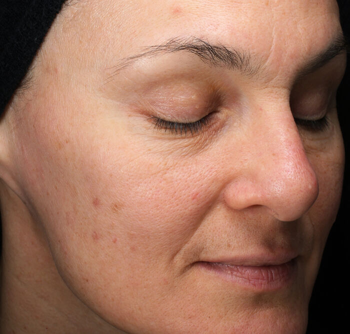 Extra Rich Cleansing Foam,