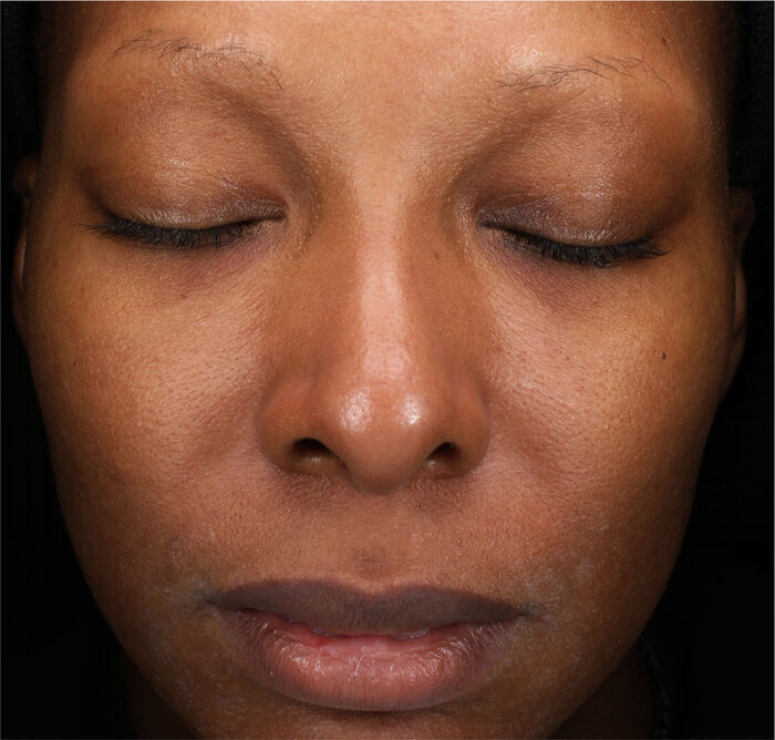 Total Regenerating Cream,