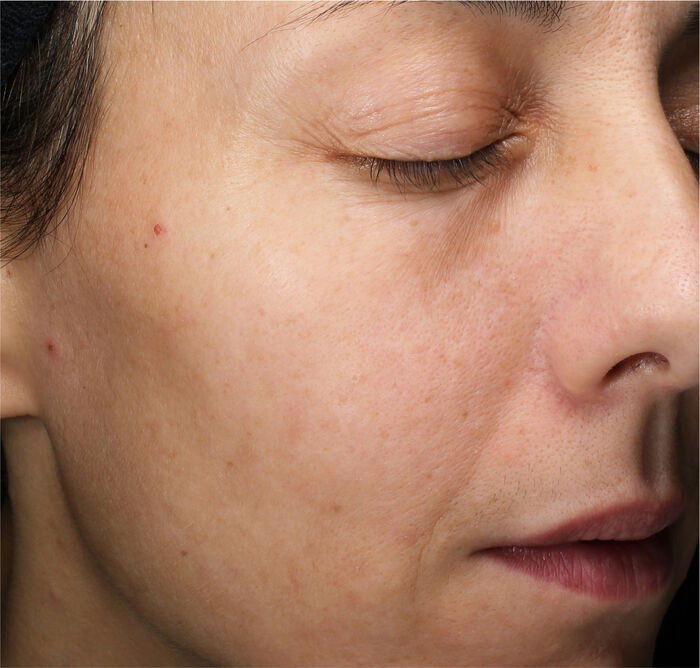 Concentrated Brightening Softener,